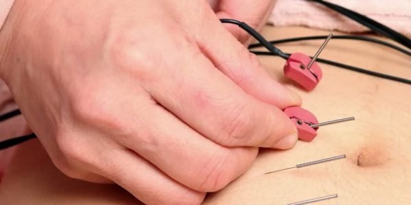 Korean traditional medicine